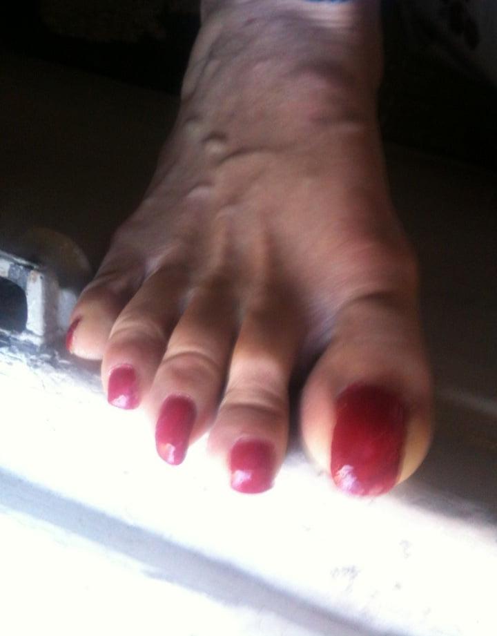 25P red toenails mix (older, dirty, toe ring, sandals mixed).