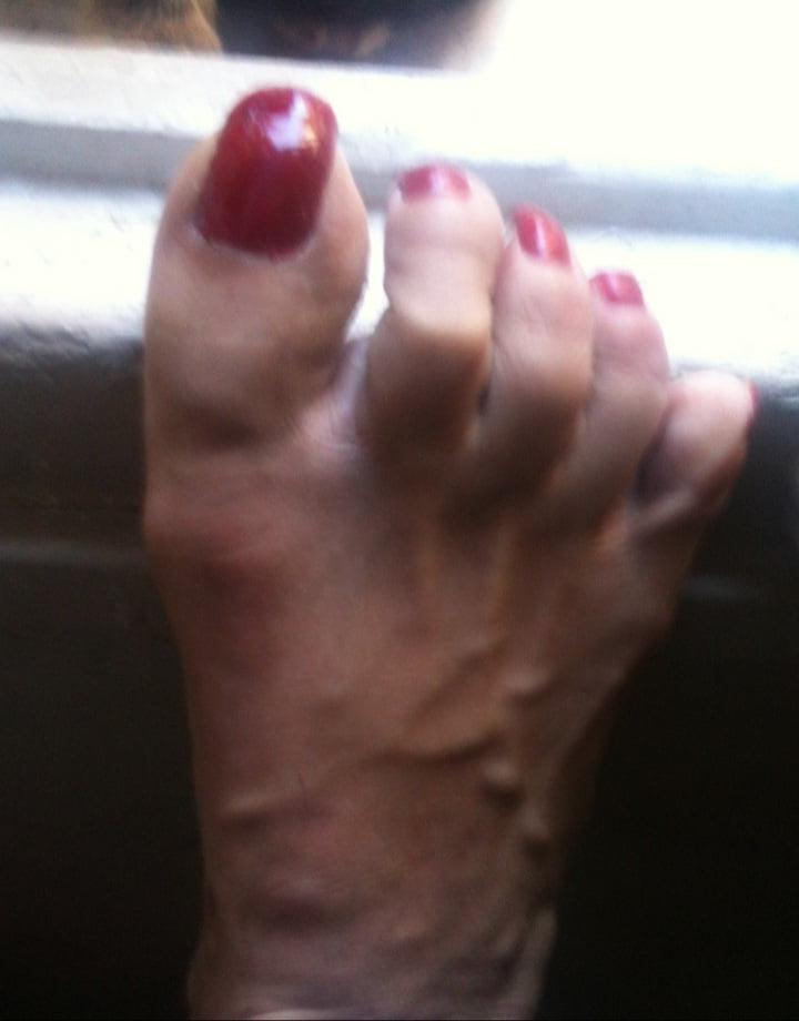25P red toenails mix (older, dirty, toe ring, sandals mixed).