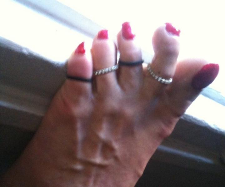 25P red toenails mix (older, dirty, toe ring, sandals mixed).