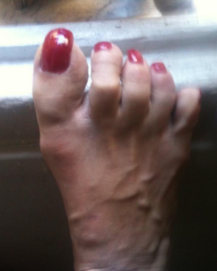 25P red toenails mix (older, dirty, toe ring, sandals mixed).
