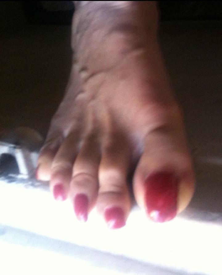 25P red toenails mix (older, dirty, toe ring, sandals mixed).