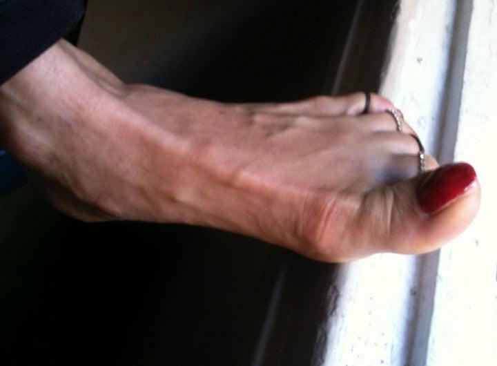 25P red toenails mix (older, dirty, toe ring, sandals mixed).