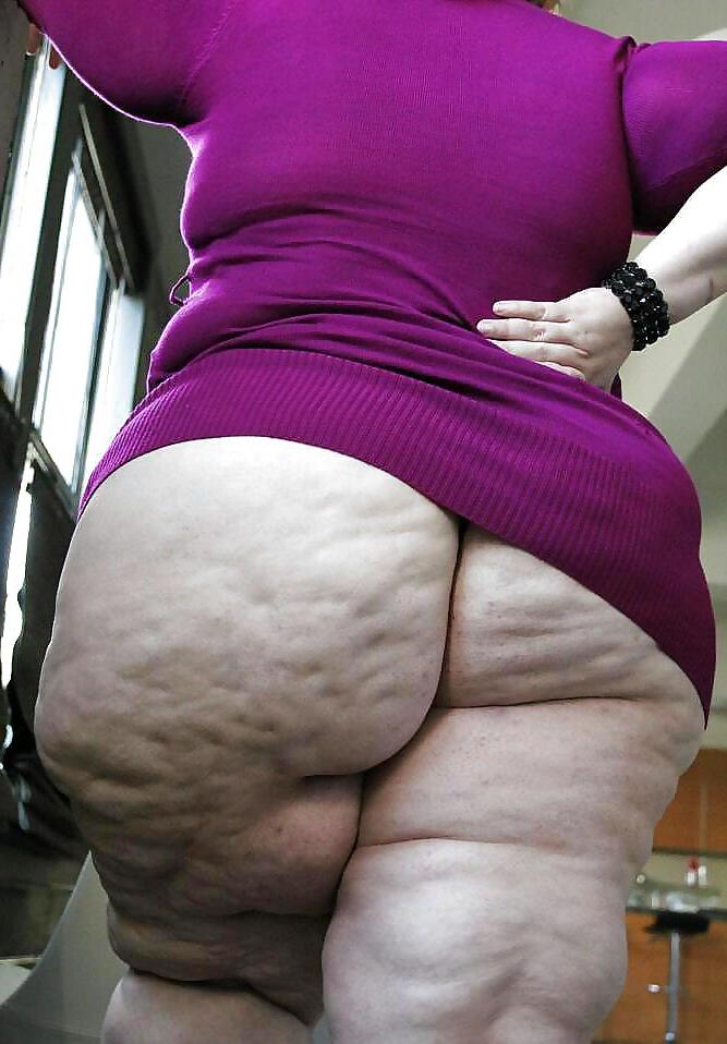 8P BBW FAT BUTT CELLULITE