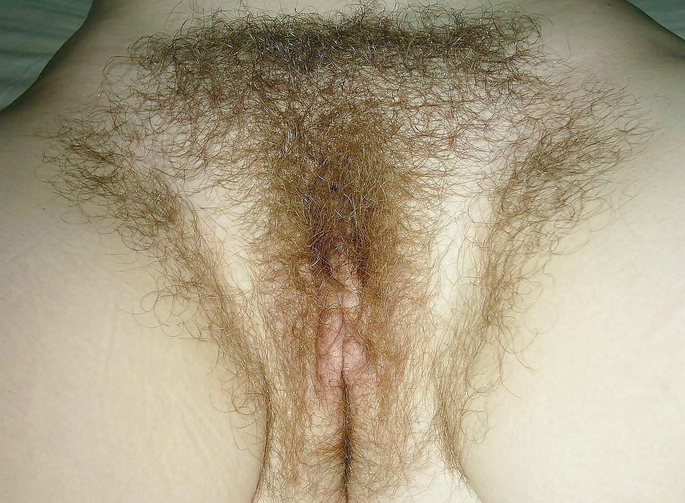 20P Pubic hair