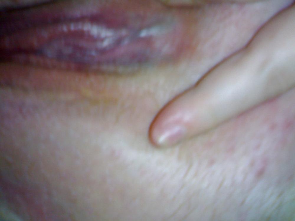8P Deutsche BBW