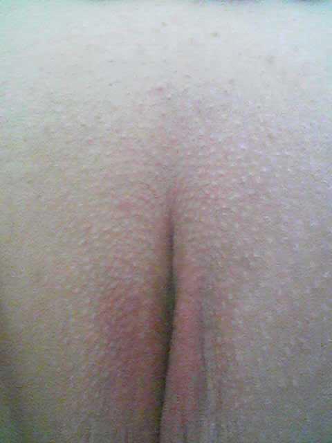 8P Deutsche BBW