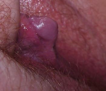 25P Big Clits and FTM Dicklets