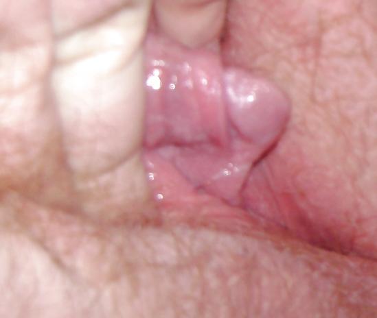 25P Big Clits and FTM Dicklets
