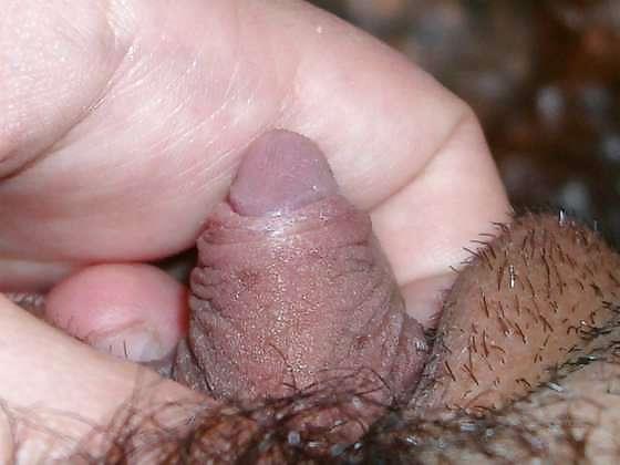 25P Big Clits and FTM Dicklets