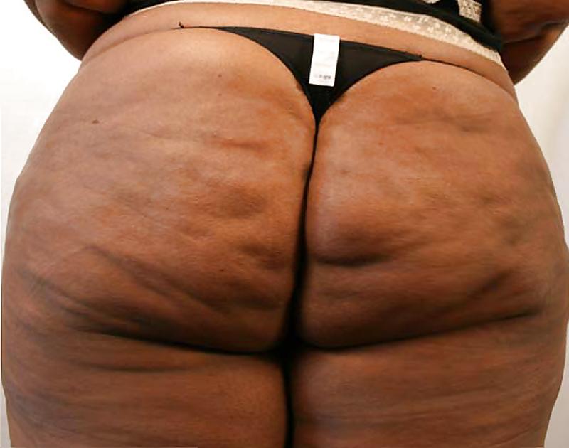 25P Only Black BBW asses,no faces.