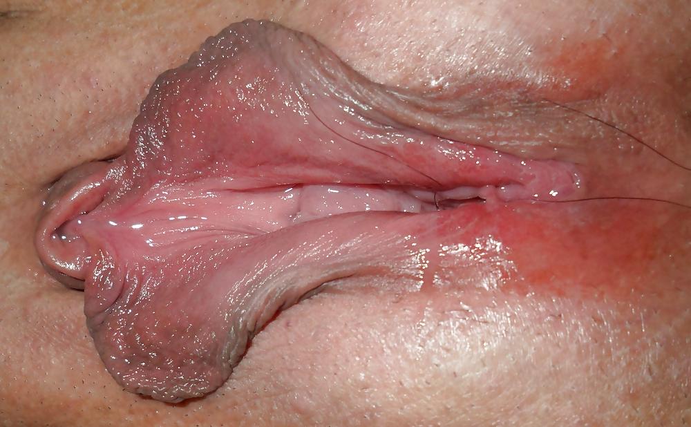 11P Labia 3