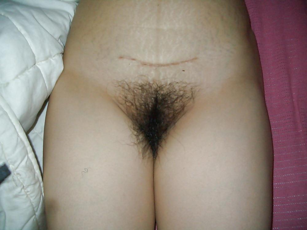 15P Asian amateur