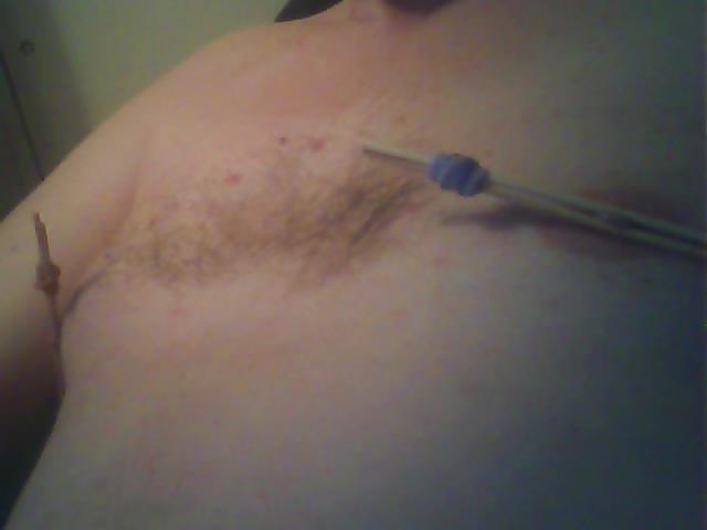 5P Nipple Sticks