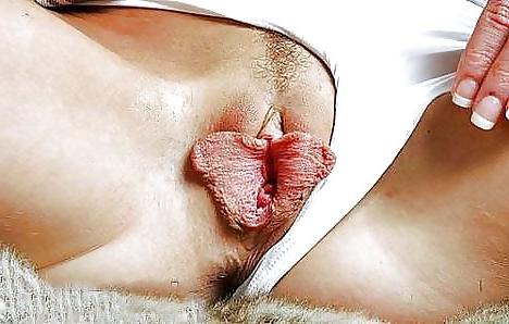 10P Labia, Minora and Majora