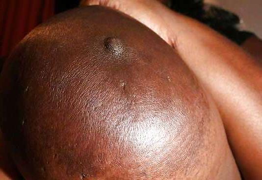 20P Bbw big huge boobs tits mix