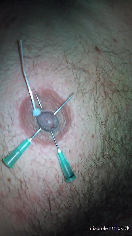 13P Nipple torture with needle
