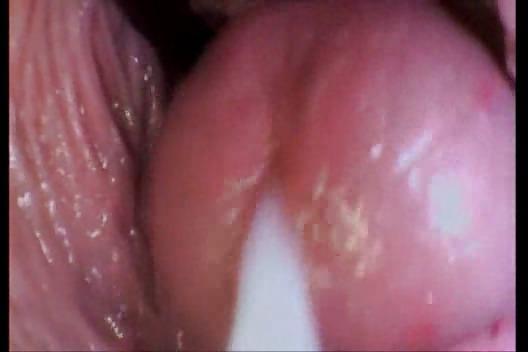 13P Milk your prostate dry!