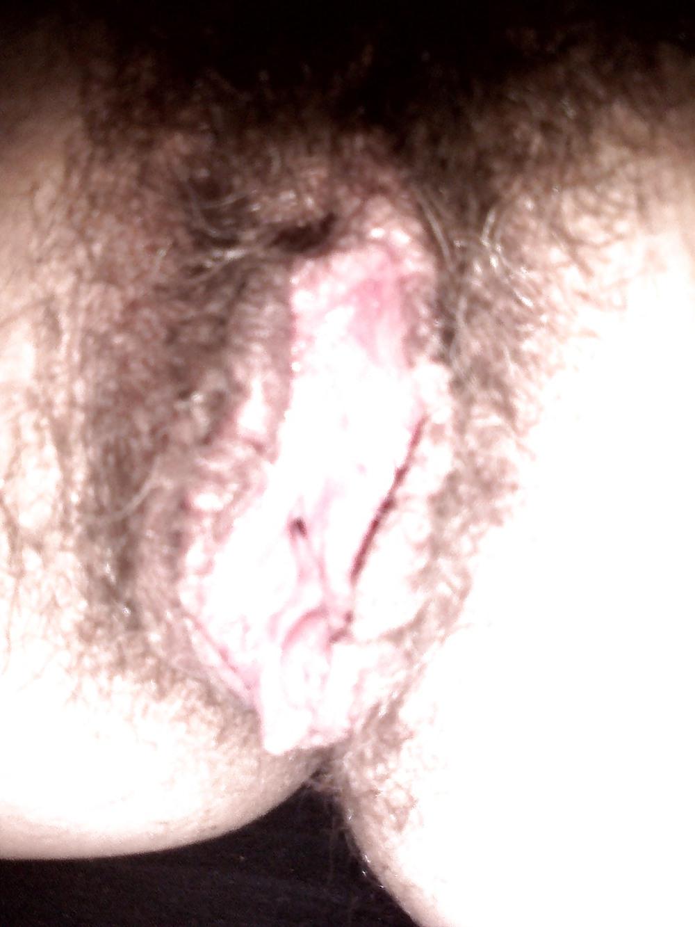 25P The Verge with Hair 1