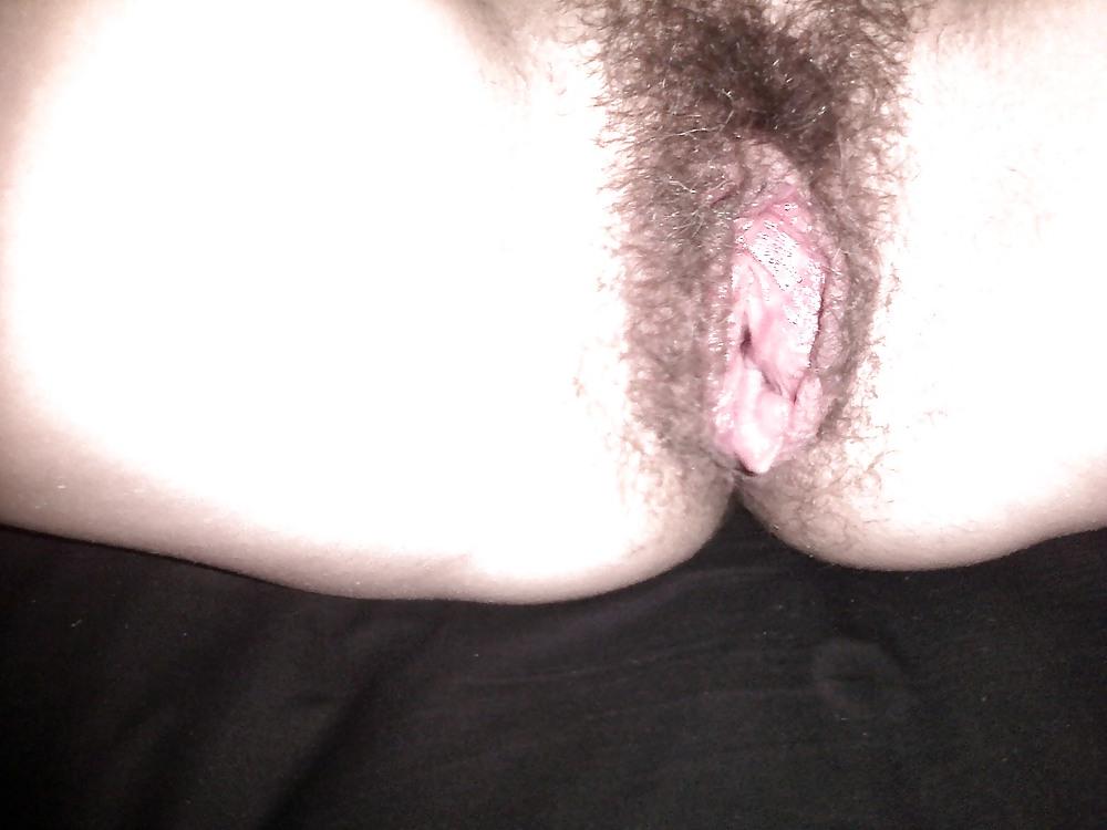 25P The Verge with Hair 1