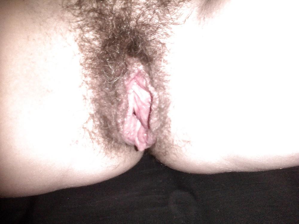 25P The Verge with Hair 1