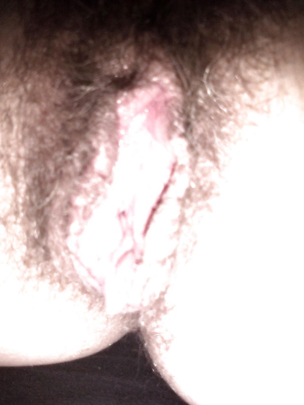25P The Verge with Hair 1