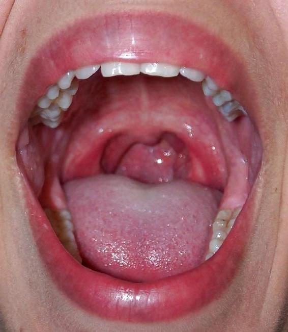 7P My mouth for uncut cock