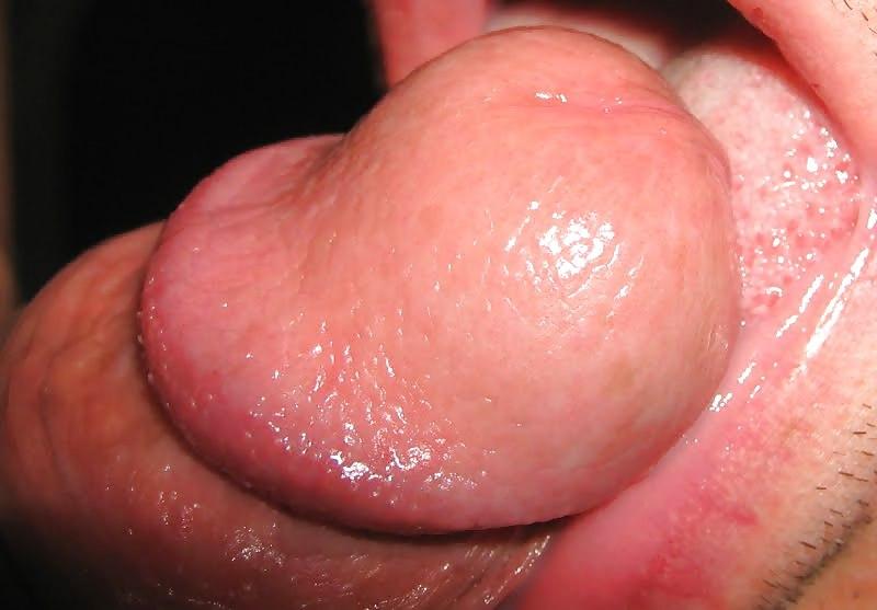 7P My mouth for uncut cock