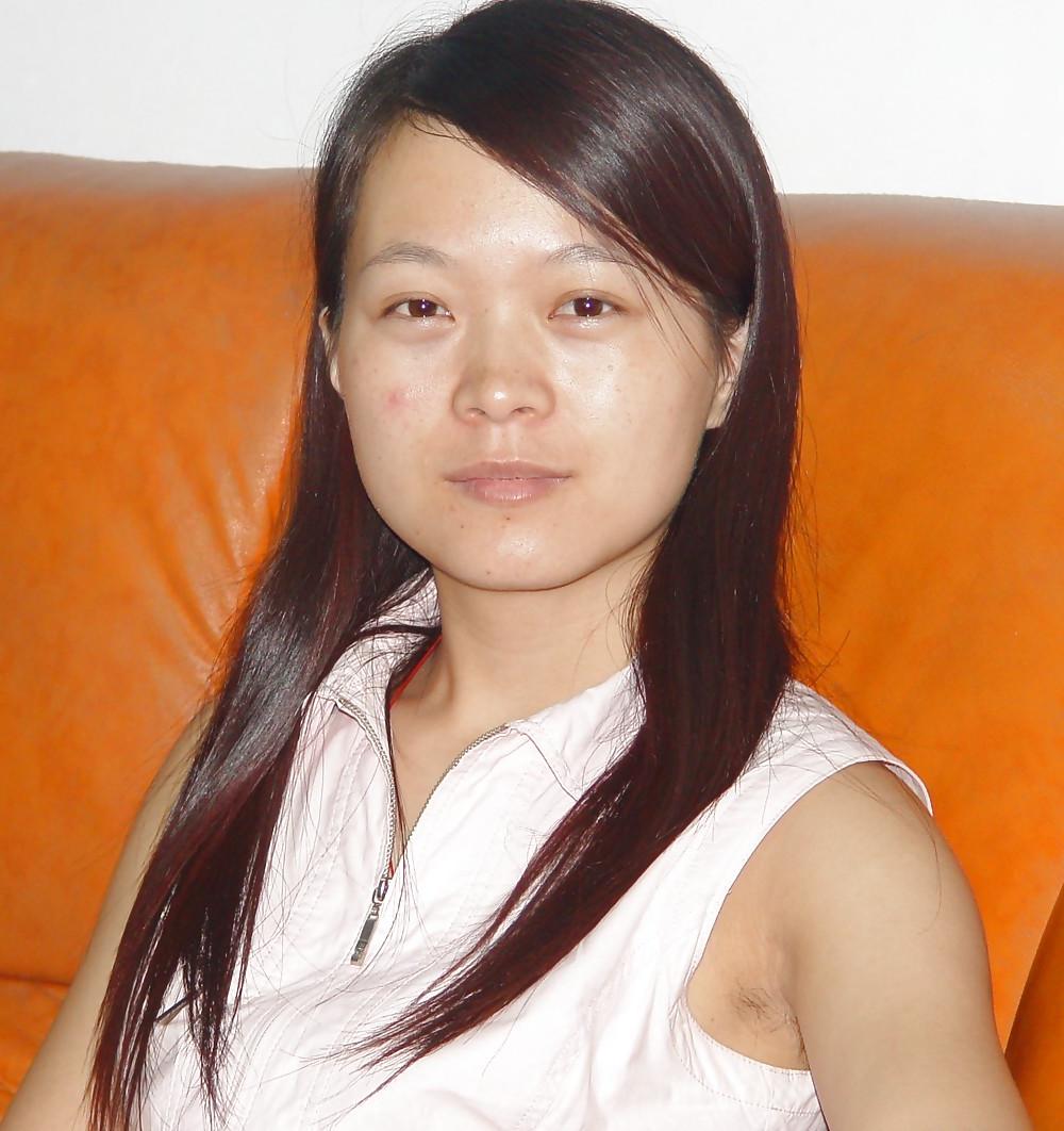 25P Underarm Hair of Asian Gals