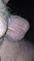 5P Hairy or smooth