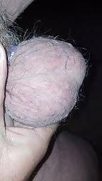 5P Hairy or smooth