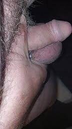 5P Hairy or smooth