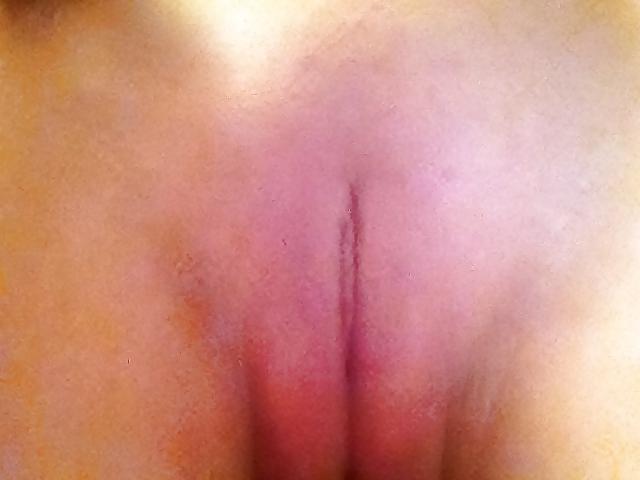 15P Nipple and hips