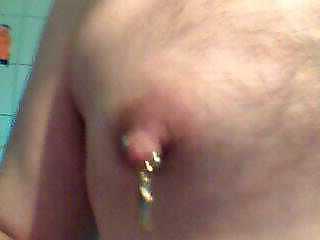 5P Nipple pain