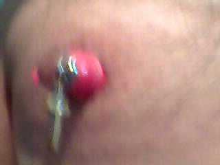 5P Nipple pain