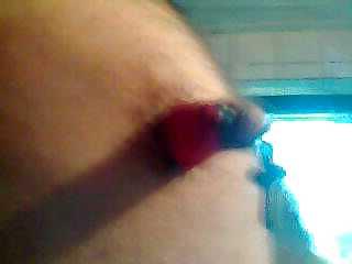 5P Nipple pain