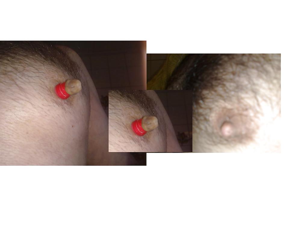 5P Nipple pain