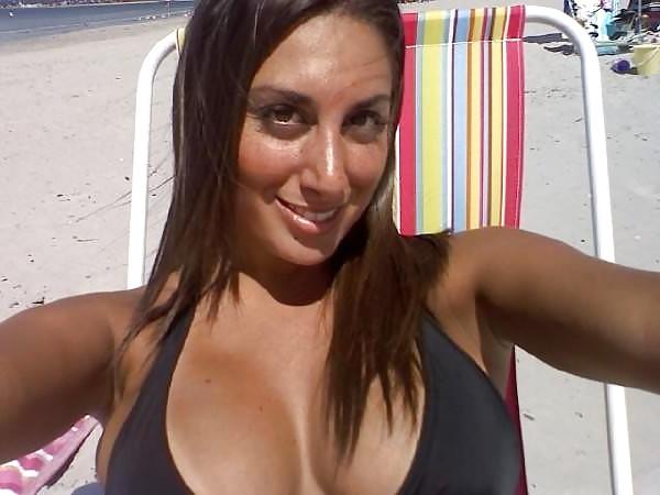 22P Cleavage 3
