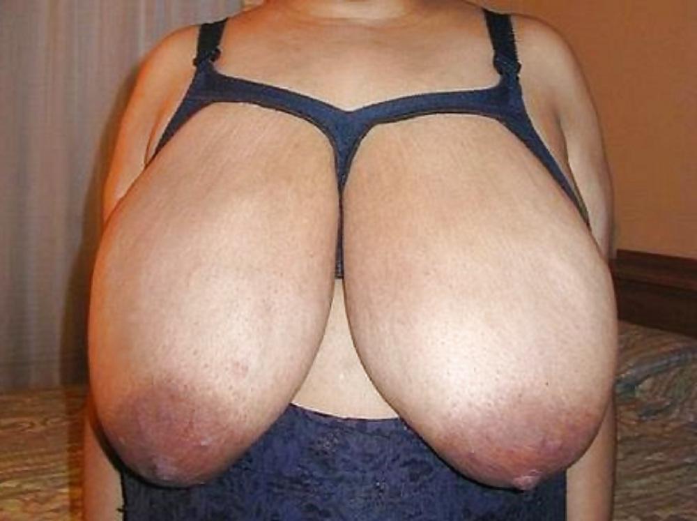 25P Big black areolas ----massive collection---- part 12