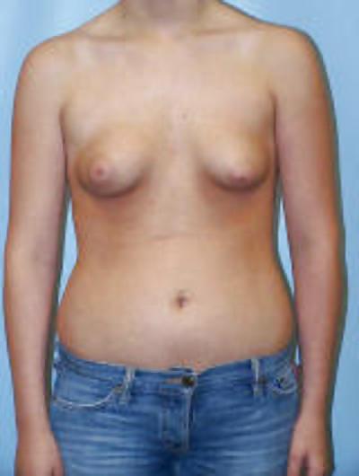 15P Puffy nipples 6