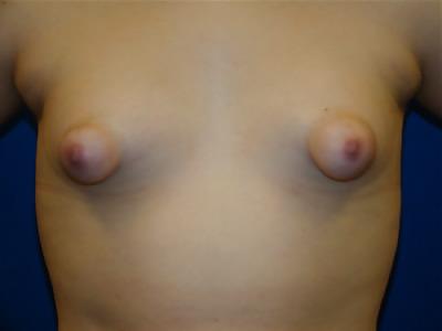 15P Puffy nipples 6