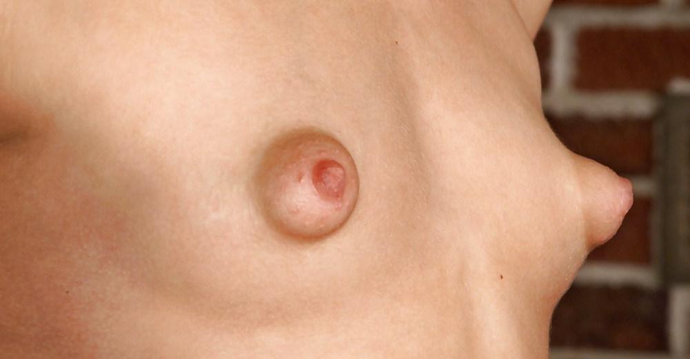 25P Puffy nipples