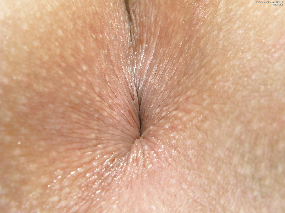 25P Large Labia fetish