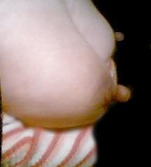 12P My nipple