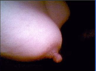12P My nipple