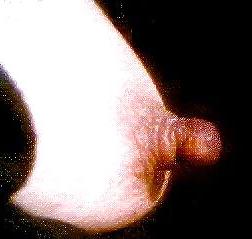 12P My nipple