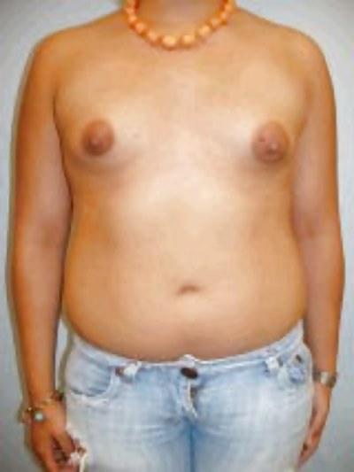 15P Puffy nipples 7