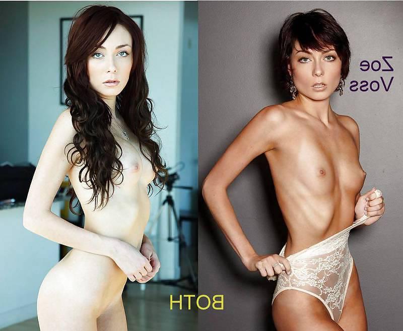 25P B4 and After Boob Job-Vote