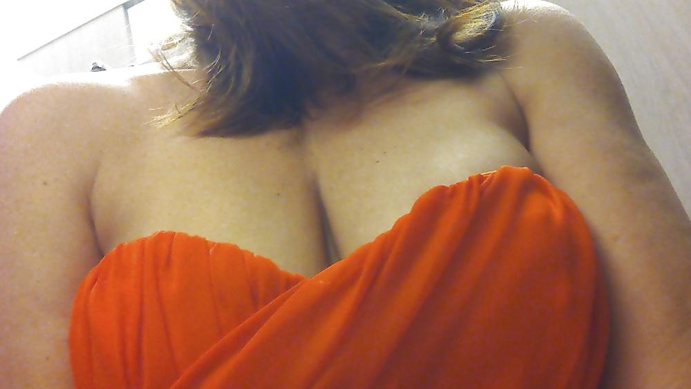 20P Cleavage - 1
