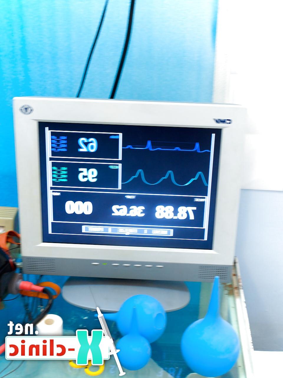 13P Forced orgasm procedure in gyno chair