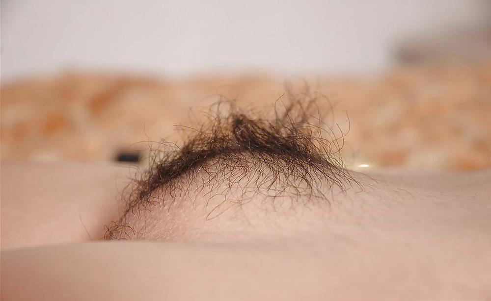 16P Hairy asian